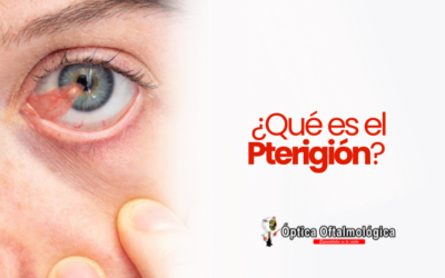 ¿Qué es el Pterigión?