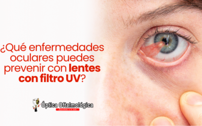 ¿Qué enfermedades oculares puedes prevenir con lentes con filtro UV?