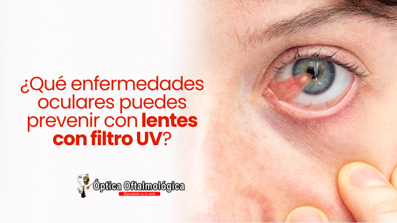 ¿Qué enfermedades oculares puedes prevenir con lentes con filtro UV?